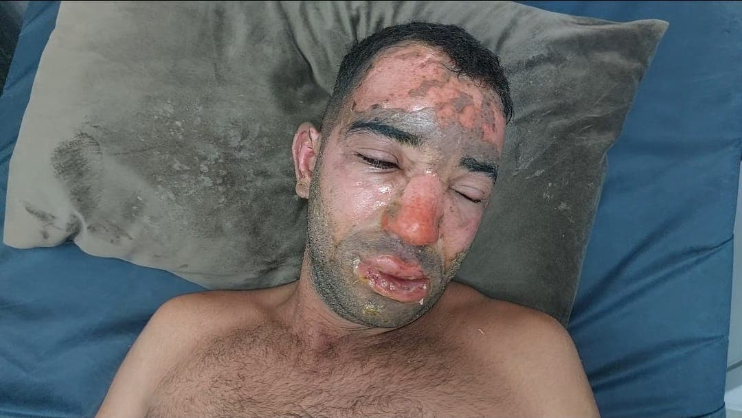 یەکێک لە بریندارەکان. وێنەکە بۆ رووداو نێردراوە