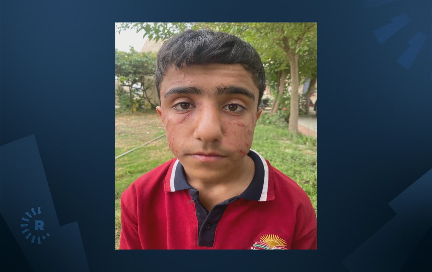 داهێنی تەمەن 14 ساڵ کە لێیدراوە و برین بە دەموچاویەوە دیارە