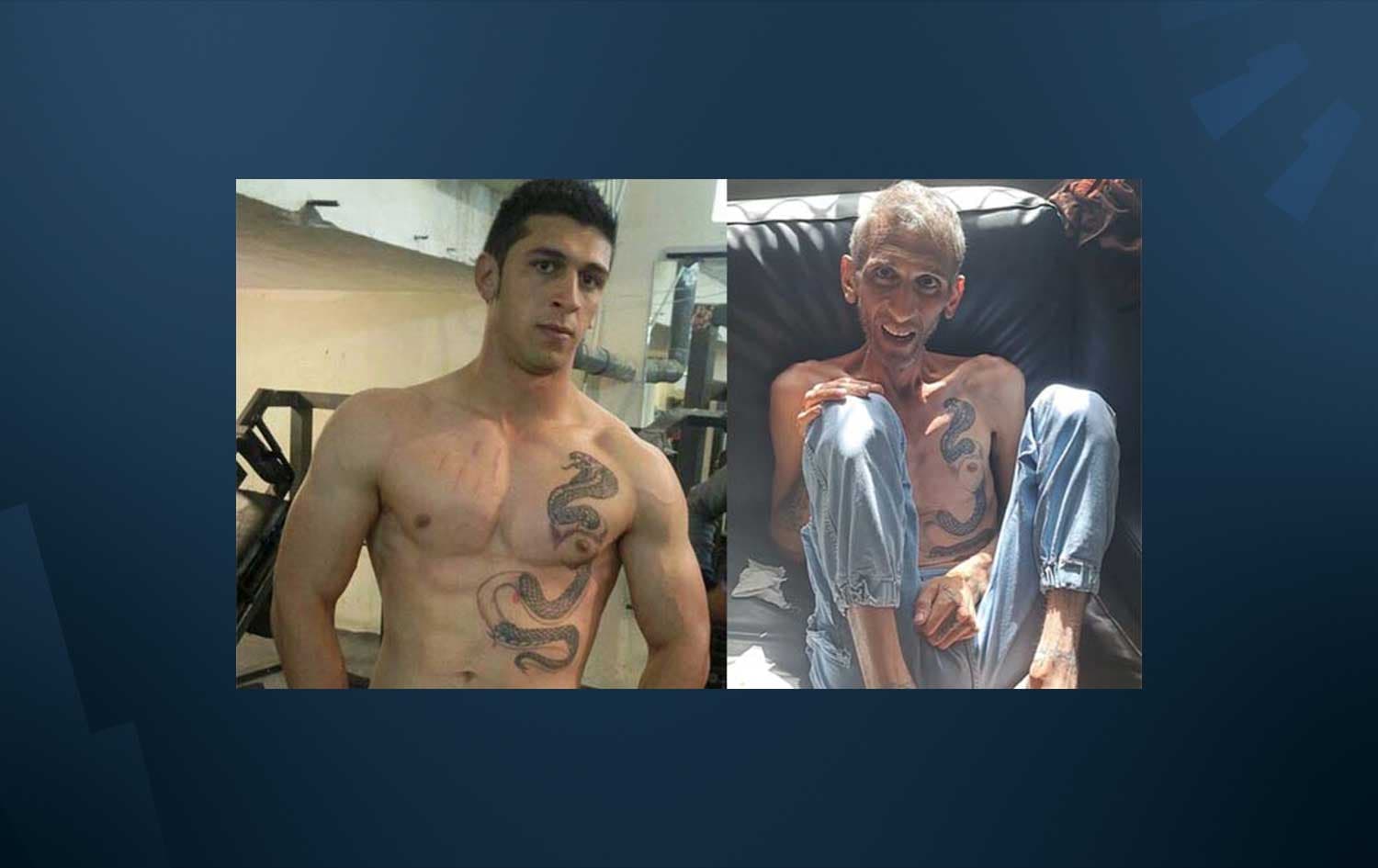 Hatam’s present emaciated condition compared to the body builder he once was. Photo: Refugee Action Coalition